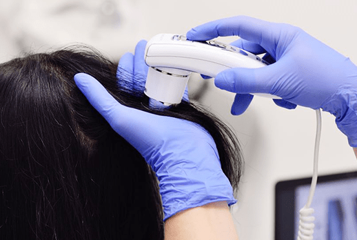 頭皮の状態をしっかりチェックできるマイクロスコープ導入